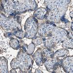 POC1A Antibody in Immunohistochemistry (Paraffin) (IHC (P))