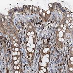 POC1A Antibody in Immunohistochemistry (Paraffin) (IHC (P))