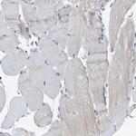 POC1A Antibody in Immunohistochemistry (Paraffin) (IHC (P))