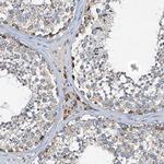 POC1A Antibody in Immunohistochemistry (Paraffin) (IHC (P))
