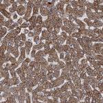 HAUS1 Antibody in Immunohistochemistry (Paraffin) (IHC (P))