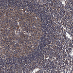 HAUS1 Antibody in Immunohistochemistry (Paraffin) (IHC (P))