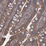 HAUS1 Antibody in Immunohistochemistry (Paraffin) (IHC (P))