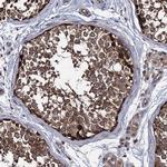 HAUS1 Antibody in Immunohistochemistry (Paraffin) (IHC (P))