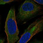 HAUS1 Polyclonal Antibody