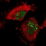 RPRD1A Antibody in Immunocytochemistry (ICC/IF)