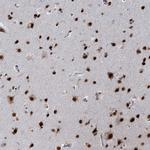 RPRD1A Antibody in Immunohistochemistry (Paraffin) (IHC (P))