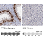 RPRD1A Antibody in Immunohistochemistry (Paraffin) (IHC (P))