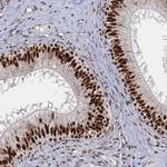 RPRD1A Antibody in Immunohistochemistry (Paraffin) (IHC (P))