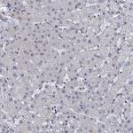 RPRD1A Antibody in Immunohistochemistry (Paraffin) (IHC (P))