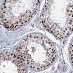 RPRD1A Antibody in Immunohistochemistry (Paraffin) (IHC (P))