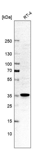 RPRD1A Antibody in Western Blot (WB)