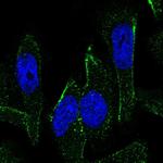 RKHD2 Polyclonal Antibody