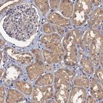 SCUBE3 Antibody in Immunohistochemistry (Paraffin) (IHC (P))