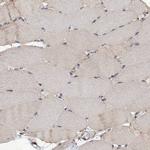 SCUBE3 Antibody in Immunohistochemistry (Paraffin) (IHC (P))