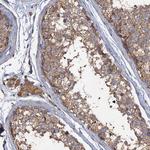 SCUBE3 Antibody in Immunohistochemistry (Paraffin) (IHC (P))
