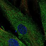 SCUBE3 Polyclonal Antibody
