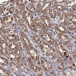 PPTC7 Polyclonal Antibody