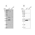 PPTC7 Antibody in Western Blot (WB)
