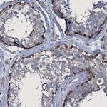 TPGS2 Polyclonal Antibody