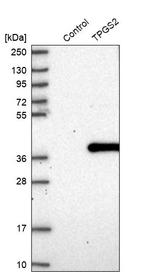 TPGS2 Antibody in Western Blot (WB)