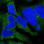 DYNC1I2 Polyclonal Antibody