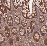 DYNC1I2 Antibody in Immunohistochemistry (Paraffin) (IHC (P))