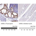 Sorbitol Dehydrogenase Antibody in Immunohistochemistry (IHC)
