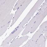 Sorbitol Dehydrogenase Antibody in Immunohistochemistry (IHC)