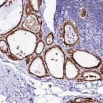 Sorbitol Dehydrogenase Antibody in Immunohistochemistry (IHC)