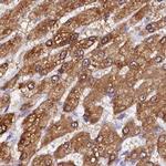 Sorbitol Dehydrogenase Antibody in Immunohistochemistry (IHC)