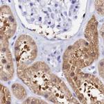 Sorbitol Dehydrogenase Antibody in Immunohistochemistry (IHC)