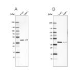 Sorbitol Dehydrogenase Antibody in Western Blot (WB)