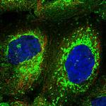 C18orf14 Polyclonal Antibody