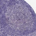 WDR76 Antibody in Immunohistochemistry (Paraffin) (IHC (P))
