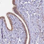 MAN2C1 Antibody in Immunohistochemistry (IHC)