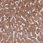 TMPRSS7 Polyclonal Antibody
