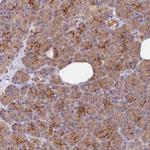 WDFY4 Antibody in Immunohistochemistry (Paraffin) (IHC (P))