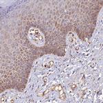WDFY4 Antibody in Immunohistochemistry (Paraffin) (IHC (P))
