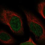 NUDT13 Polyclonal Antibody