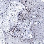 NUDT13 Antibody in Immunohistochemistry (Paraffin) (IHC (P))
