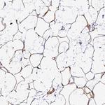 THRSP Antibody in Immunohistochemistry (Paraffin) (IHC (P))