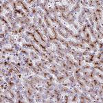 THRSP Antibody in Immunohistochemistry (Paraffin) (IHC (P))
