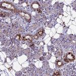 THRSP Antibody in Immunohistochemistry (Paraffin) (IHC (P))
