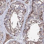 EDC3 Polyclonal Antibody