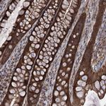 HAUS1 Polyclonal Antibody