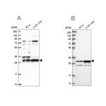 HAUS1 Antibody in Western Blot (WB)