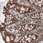 ANKRD26 Antibody in Immunohistochemistry (Paraffin) (IHC (P))