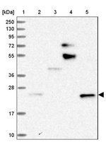 STARD5 Antibody in Western Blot (WB)