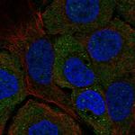 STARD5 Polyclonal Antibody